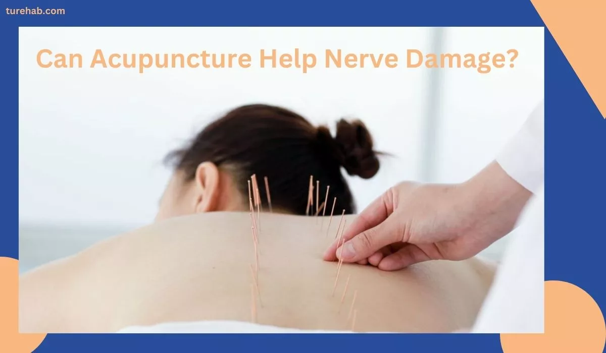 Can Acupuncture Help Nerve Damage