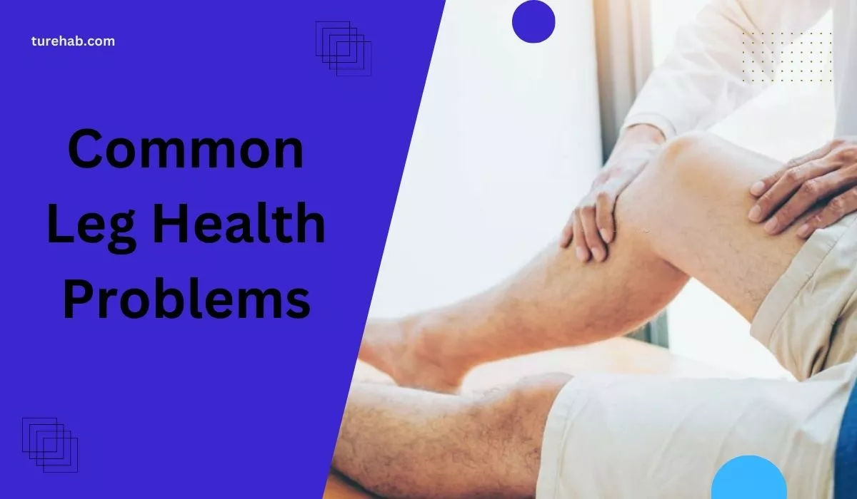 Common Leg Health Problems