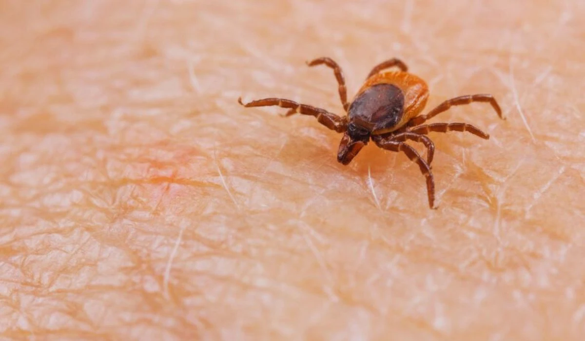 First Travel-Related Death From Rare Tick-Borne Virus