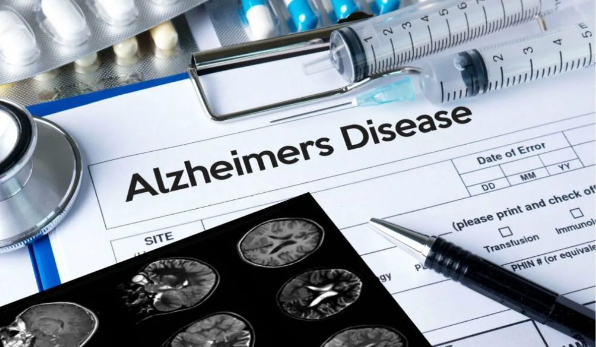 Research Points To A Halt In Alzheimer's Disease Advancement.