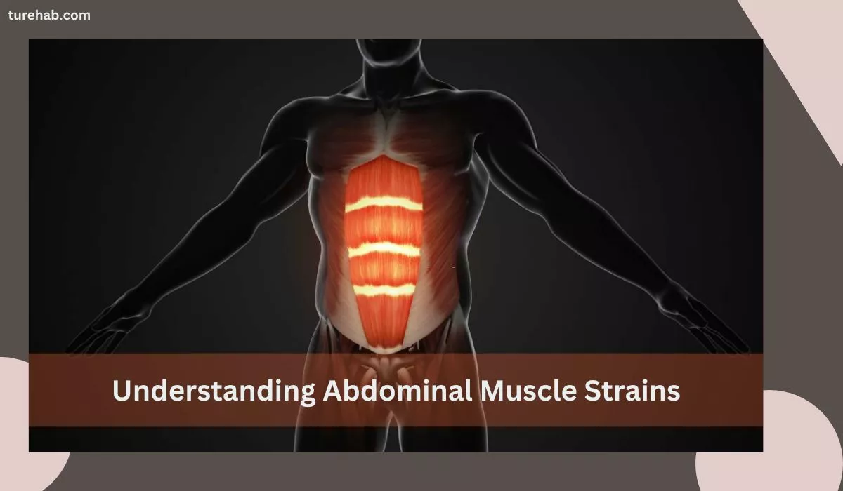 Understanding Abdominal Muscle Strains